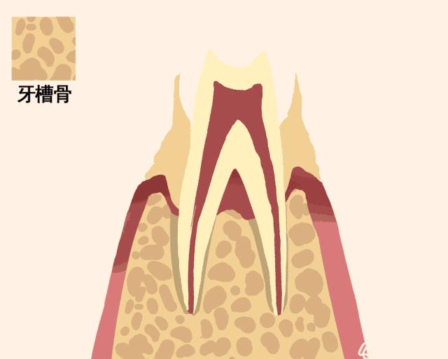 牙齿如何正确的脱落,一张动图告诉你