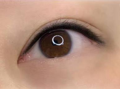 美瞳怎么处理视频教程,美瞳正确处理方式