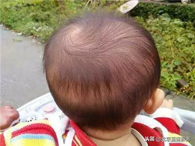 宝宝枕秃的原因及治疗方法盘点，准妈妈们收好啦