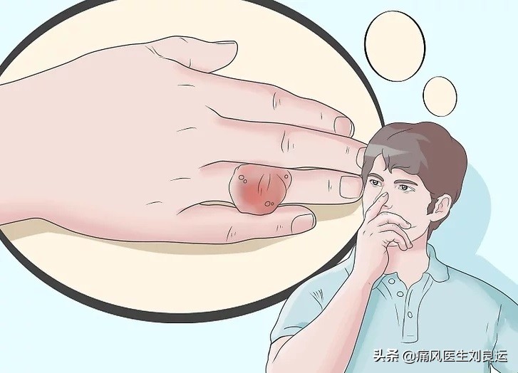 可能你不知道的有效偏方,医生常用的痛风十大特效药