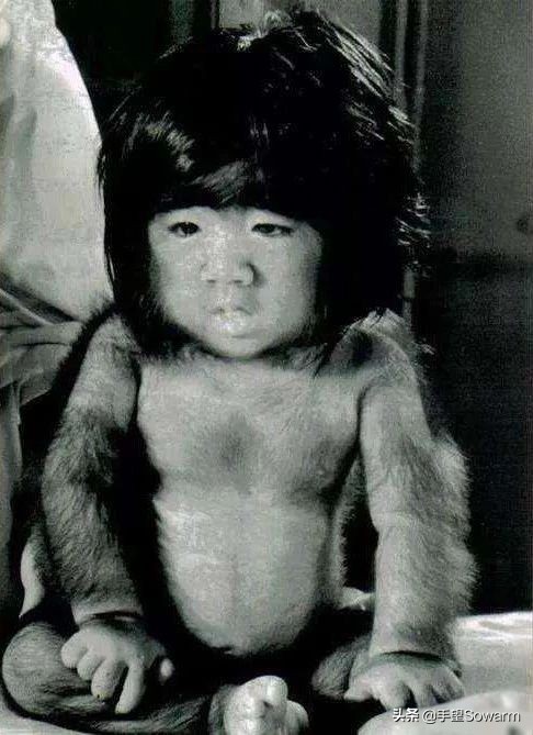 全世界体毛最多的人，是如何在歧视中逆袭为实力派歌手的？