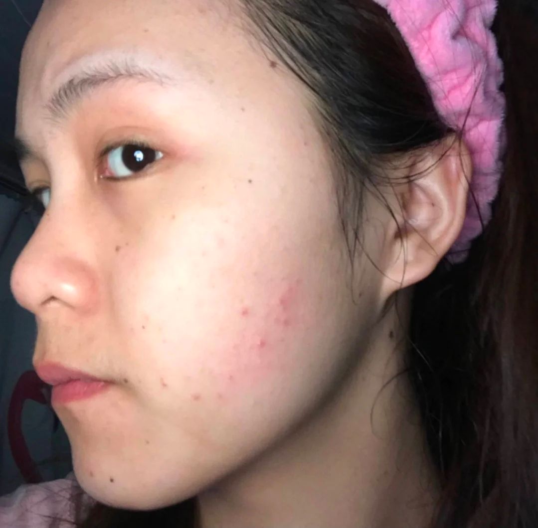 你的洗面奶上排名了吗,哪几种洗面奶上黑名单