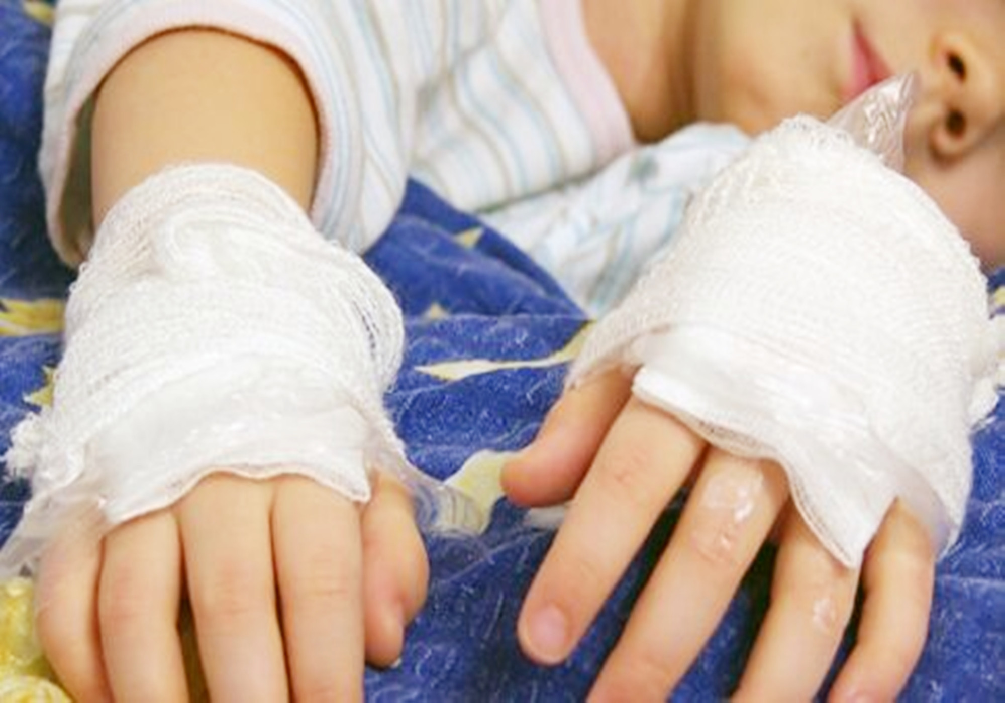 2岁多宝宝咬502胶水,宝宝把502胶水弄到口腔里怎么办