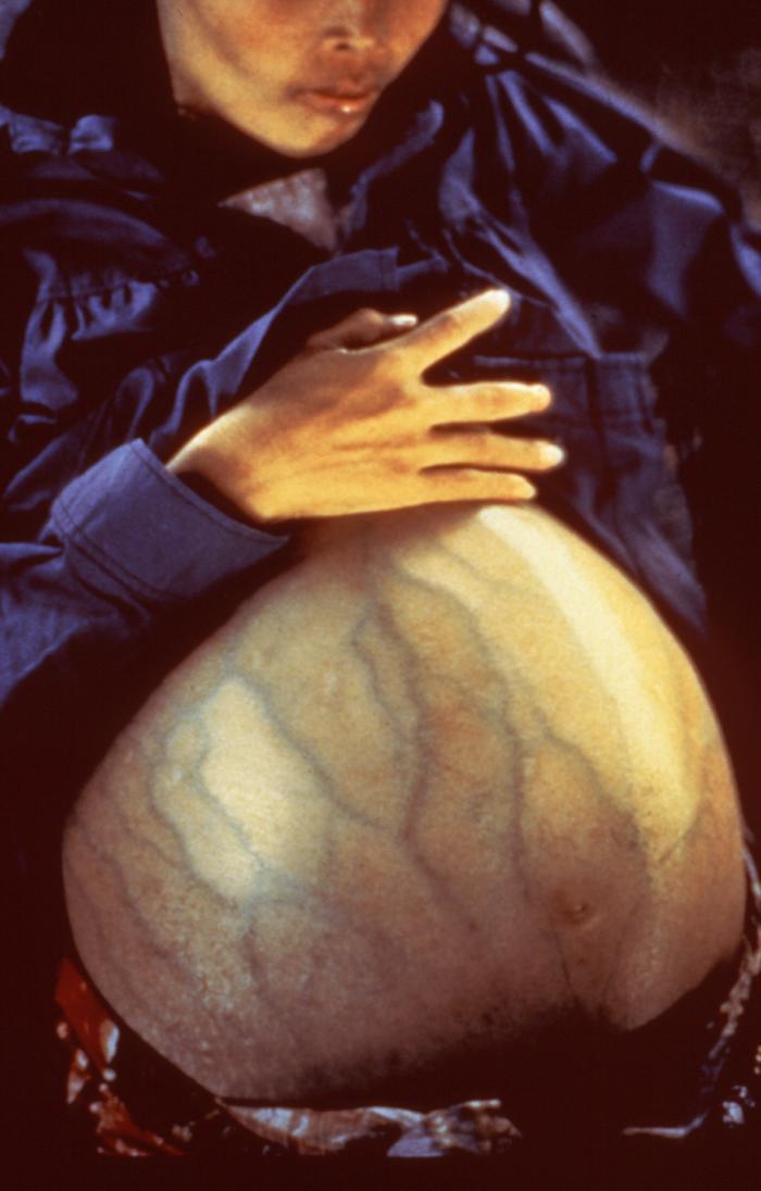 百白破和百白破hib是免费的么,白破百白破区别