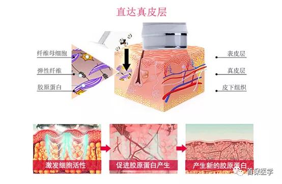 光子嫩肤家用仪器真的有用吗,你真的了解你的皮肤吗