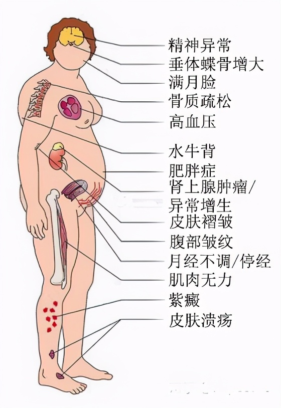 打封闭止痛快？去骨刺不再痛？骨关节炎患者止痛需避开四大陷阱
