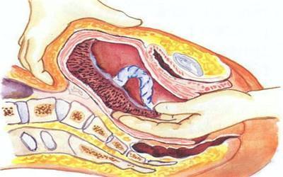 生完孩子产道多久可以恢复,生完孩子产道会松弛吗