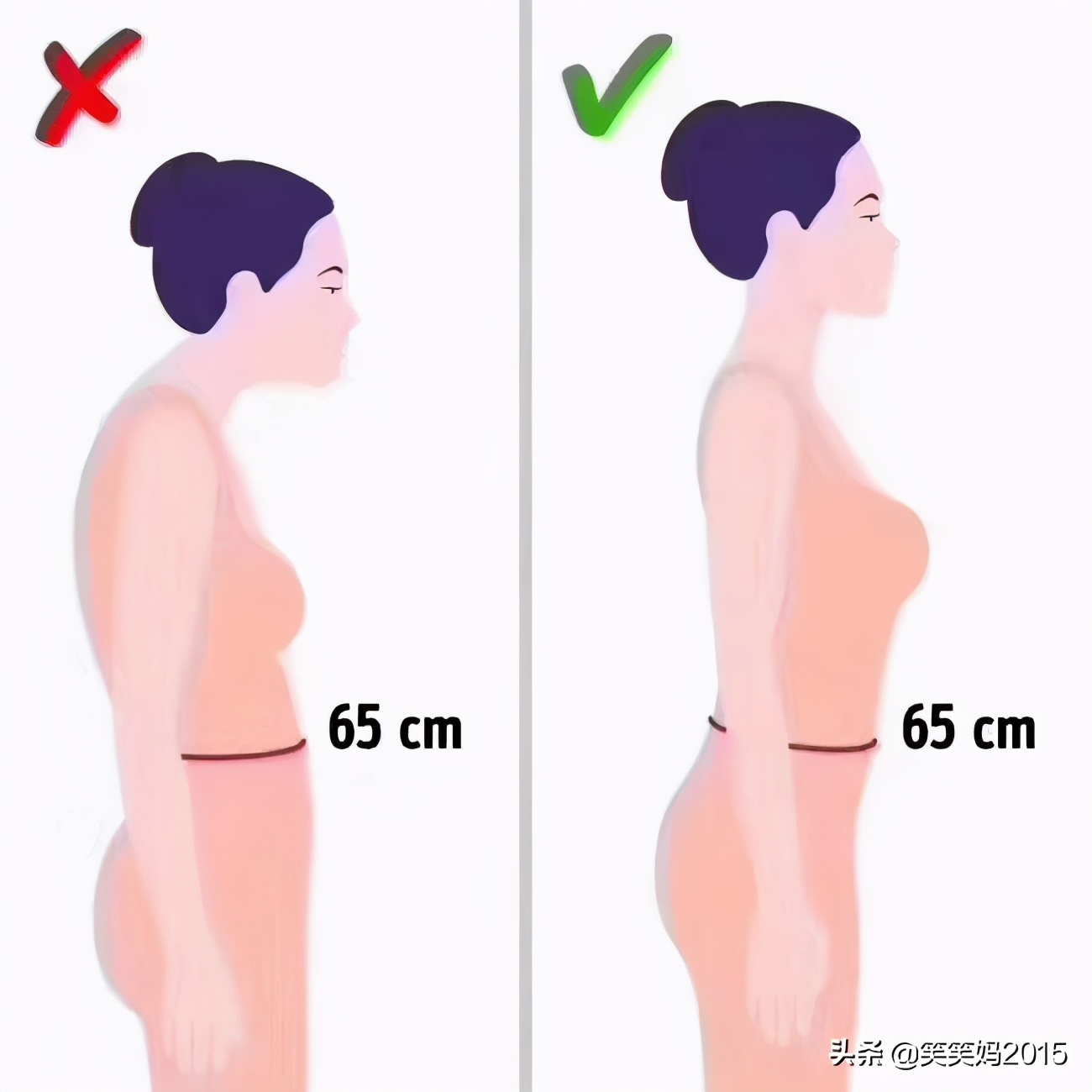 产后驼背下垂怎么锻炼,产后含胸驼背训练方法