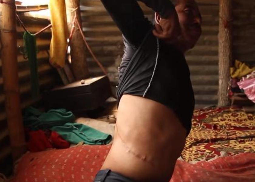 尼泊尔的穷人有多惨,尼泊尔靠肾发财的视频