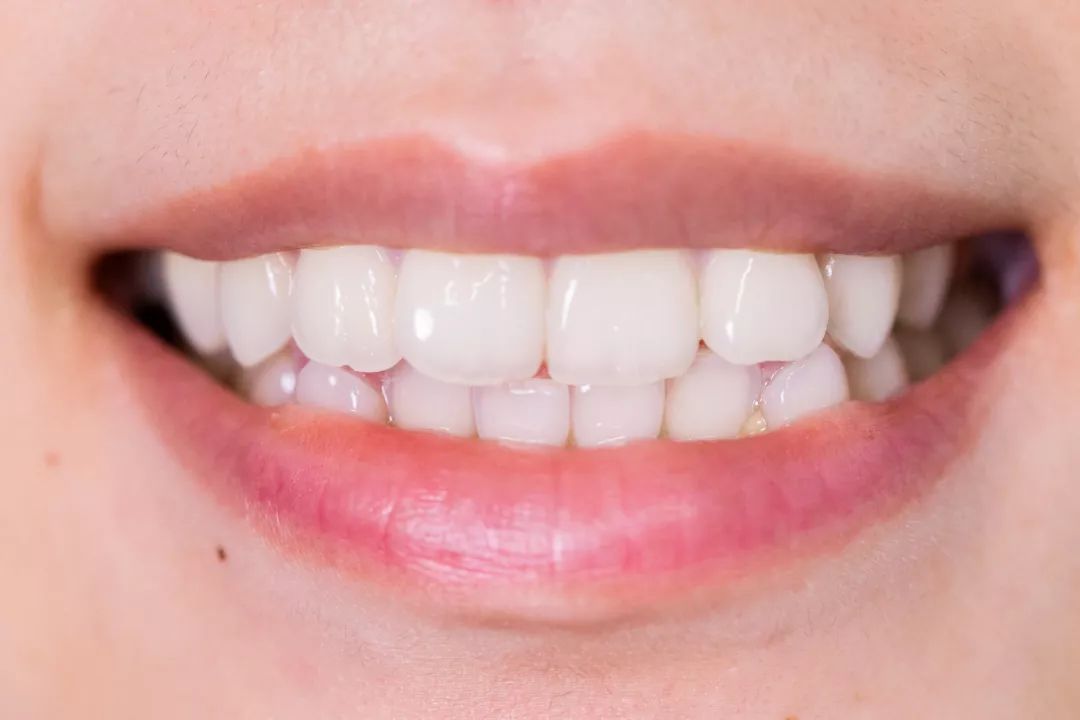 最好用的洗大黄牙的牙膏,马卡龙牙膏去牙垢方法