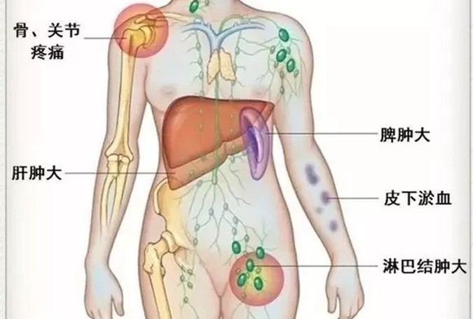 左侧腹部疼看什么科,左侧腹部疼是什么病