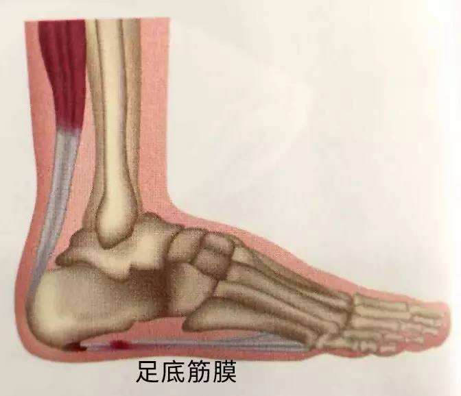 产后3个月睡醒脚后跟疼怎么回事,产后脚后跟疼一招解决