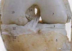 怎么判断交叉韧带损伤,膝关节交叉韧带损伤专家