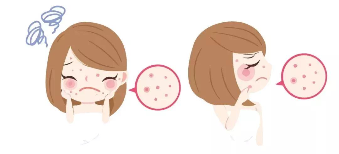 祛痘印最有效的方法,有什么祛痘印最有效的方法