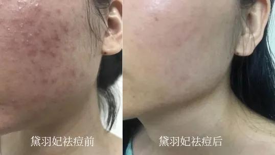 居家护肤就可以？为什么越来越多人离不开美容院？