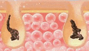 清洁毛孔的洁面皂,保持洗完脸的面部透亮