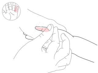 宝宝退烧可以推拿哪个穴位,宝宝发热推拿哪个部位图解