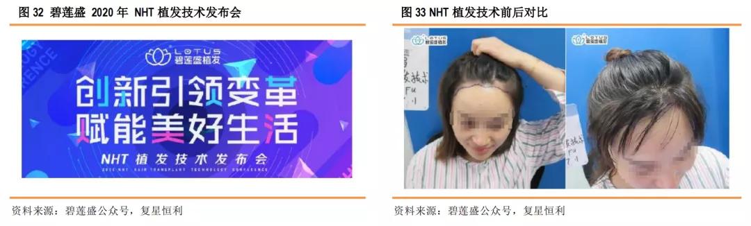 星盘研究4.0,健康植发行业发展趋势