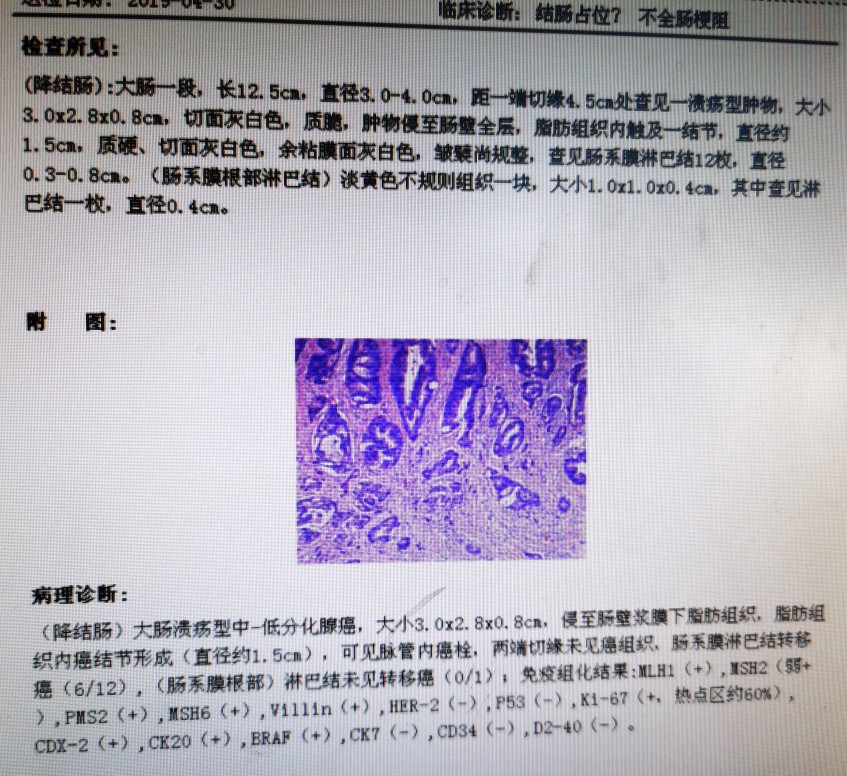 直肠癌转移肺部ct报告单怎样提示,直肠癌转移到肝肺部还能活多久