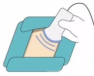 甲状腺结节频发，该拿它怎么办才好？