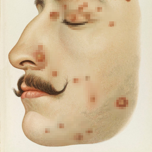 姊呮瘨涓嶆不鑷剤,姊呮瘨涓嶆不鑰屾剤