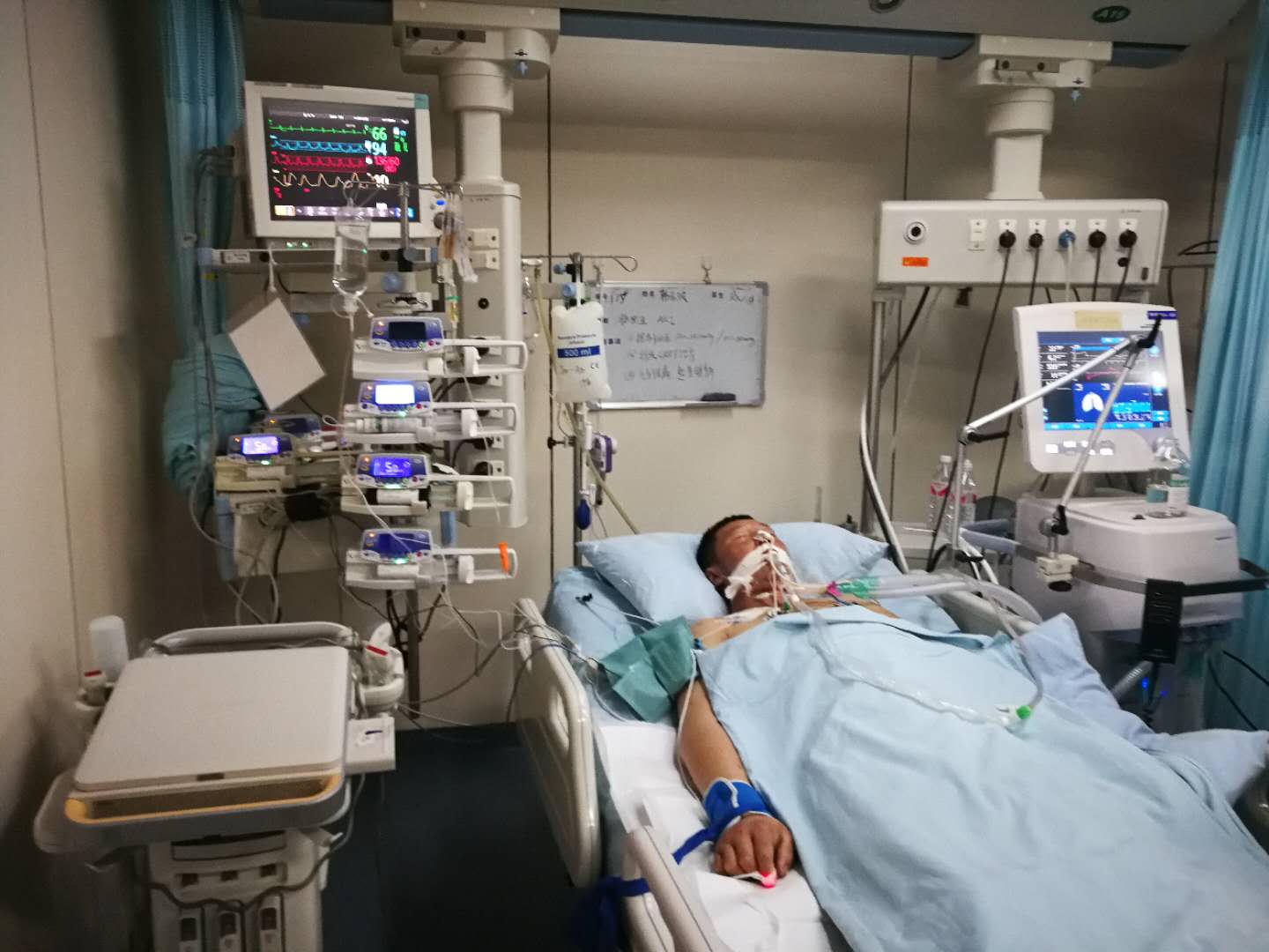 icu病房抢救过来的真实感受,icu里的病人没有意识吗意味着什么