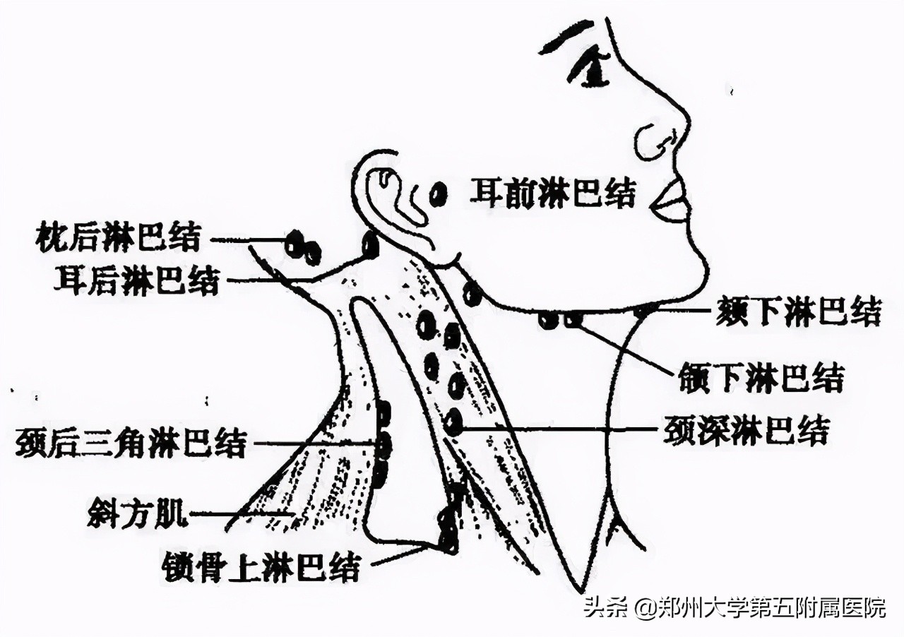 有一个小小的淋巴结,淋巴结有小尾巴