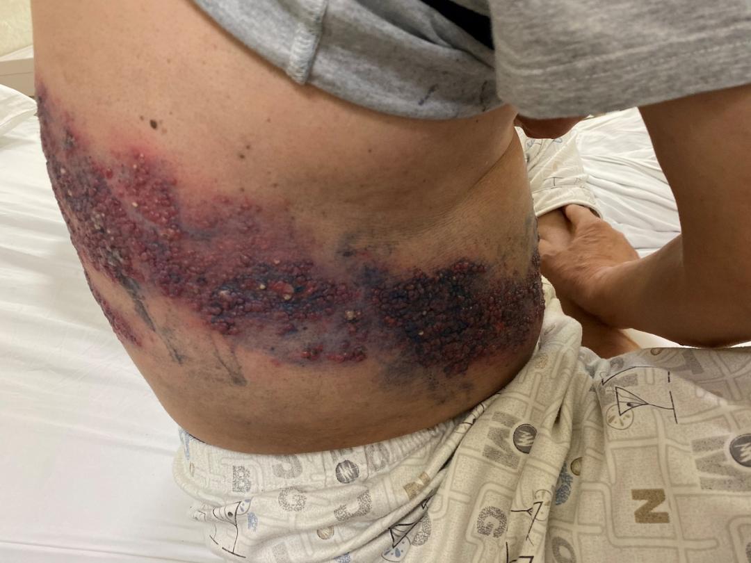 这条“缠腰火龙”太厉害，被它“缠”上真够呛