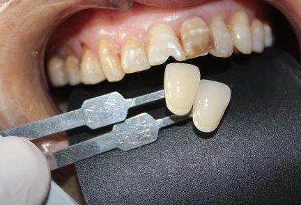 种植的牙齿松动了怎么办,牙齿松动2年可拔牙吗还能种植吗