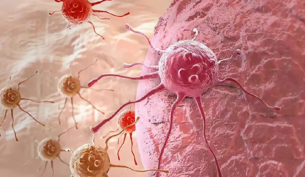 姚贝娜癌症是过度治疗吗,姚贝娜为什么死于乳腺癌