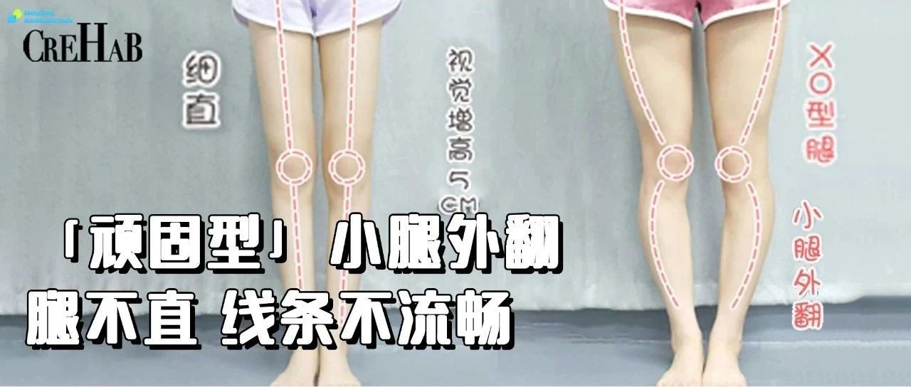 练腿攻略：3个简单动作，消除顽固型小腿外翻