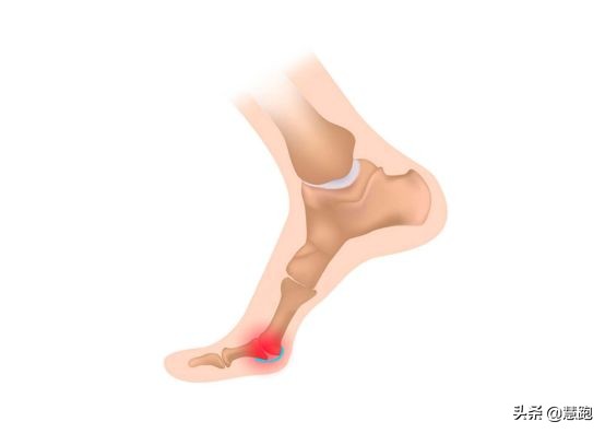 跑者买跑鞋的理由,跑者买大一码还是正码