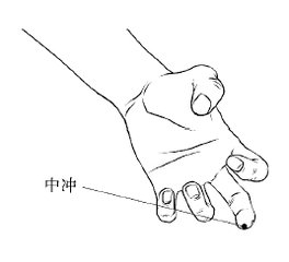 刺血疗法怎样操作,刺血疗法大全看这一篇就够了