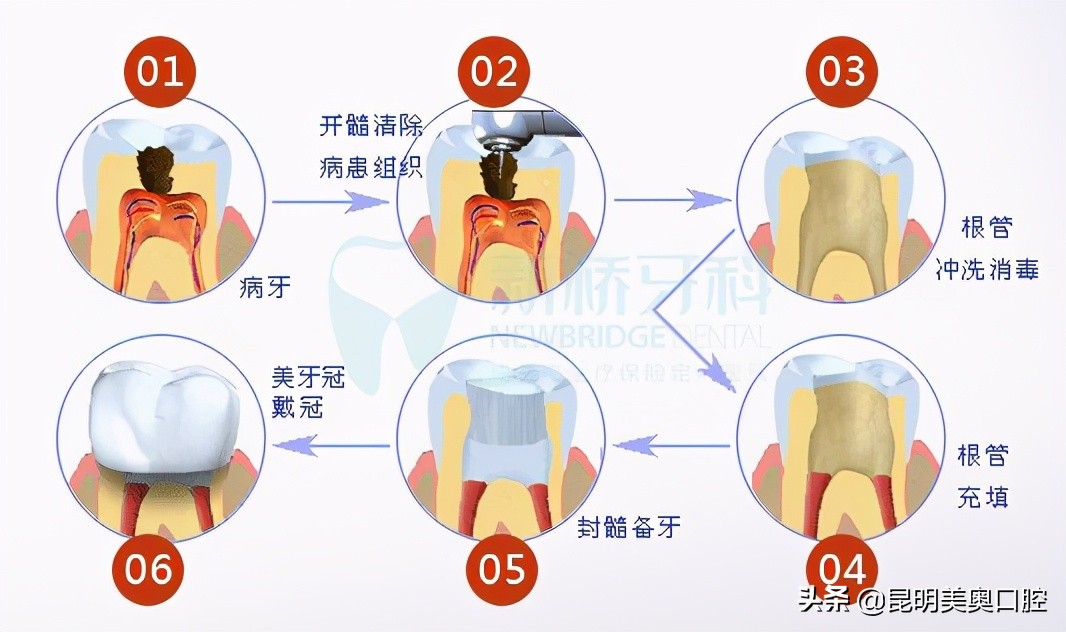 牙龈萎缩导致牙齿脱落怎么办,牙龈萎缩牙齿脱落如何治疗