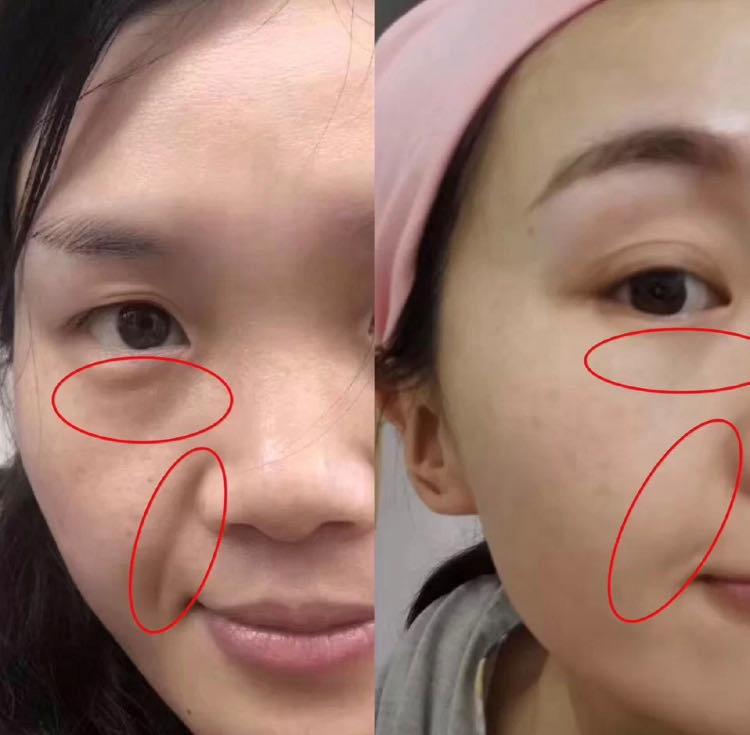 贝嫂维多利亚整鼻子了吗,贝嫂维多利亚化妆视频