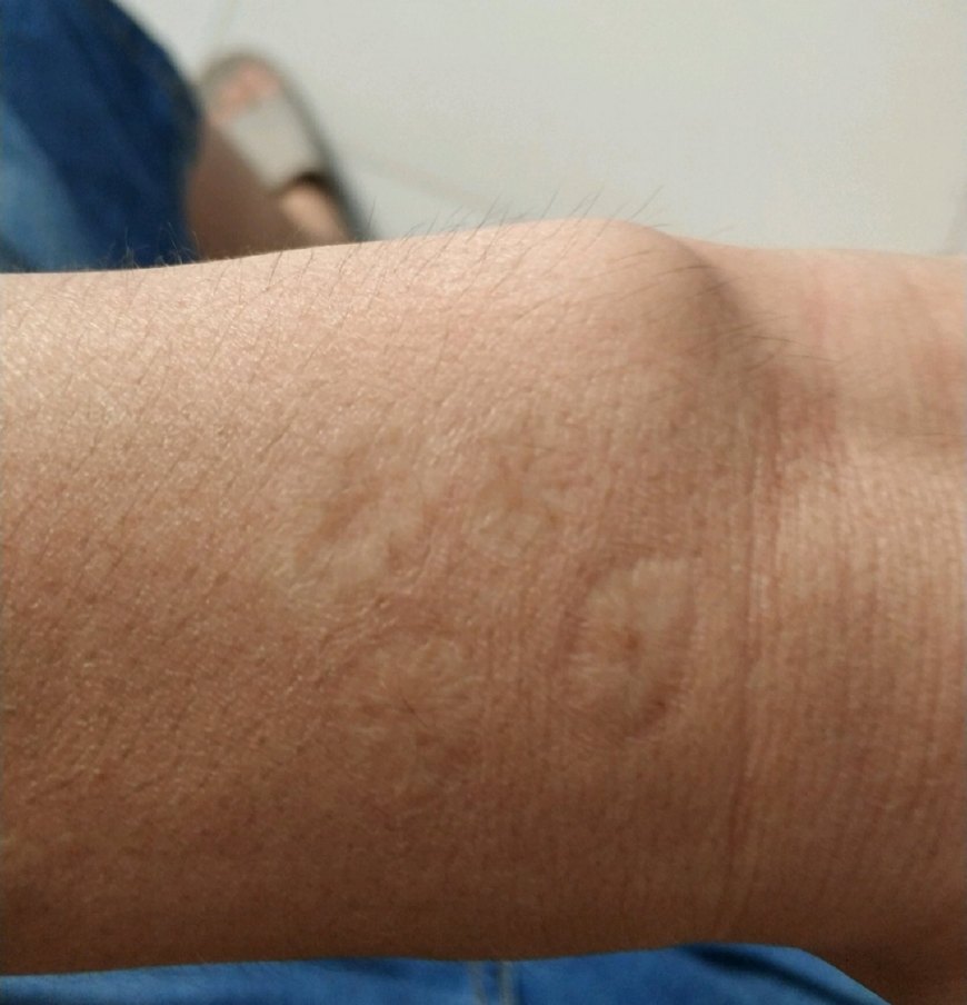 某工友想进富士康工作，却被告知身上有刀疤的不能收