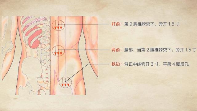 坐骨神经痛针灸哪个穴位止痛最快,坐骨神经痛三个穴位搞定