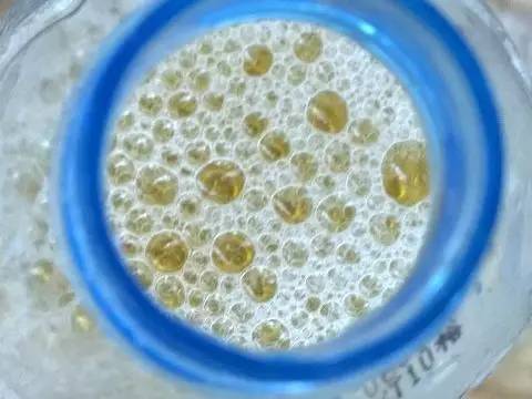 尿液带泡沫浑浊,尿液带泡沫是糖尿病吗