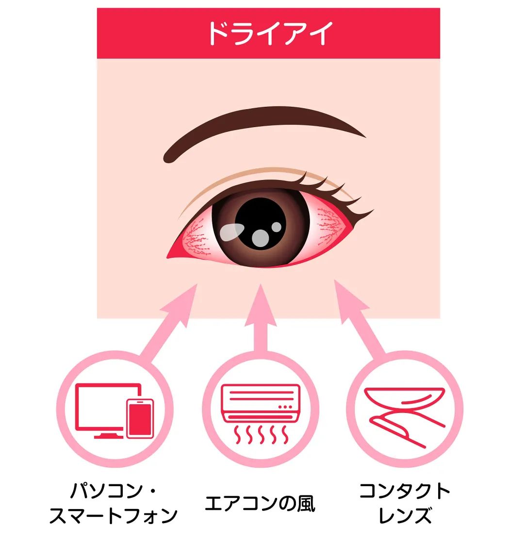 有效去除眼纹眼霜,眼纹可以通过医美什么方式治疗