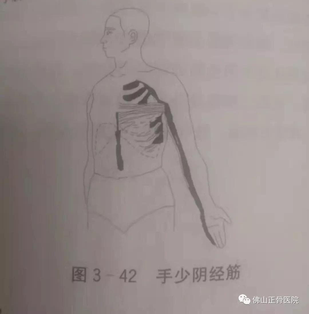 经筋手法，我院名誉院长国医大师韦贵康《韦氏骨伤手法集成》