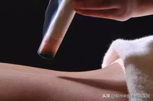 宫寒的4个信号预示子宫寒冷,宫寒真的是子宫寒冷吗