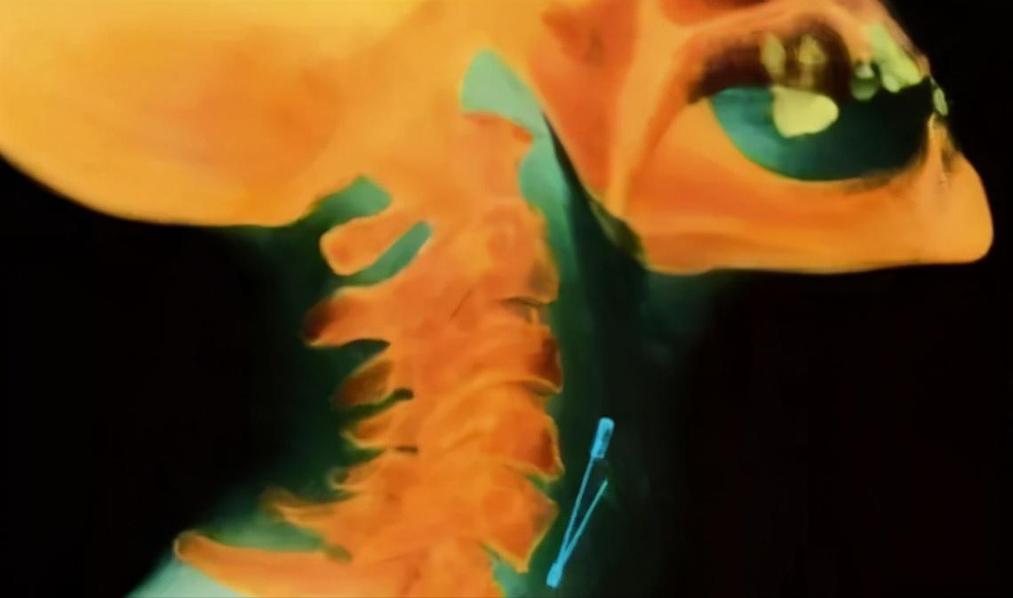 50cm“仙女管”插入少女胃里,这种自虐工具竟在淘宝卖疯了