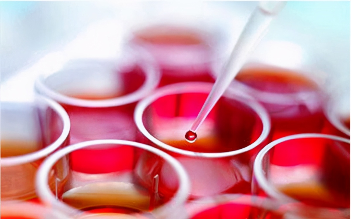 慢性嗜酸性粒细胞性肺炎怎么预防,嗜酸性粒细胞性肺炎治疗