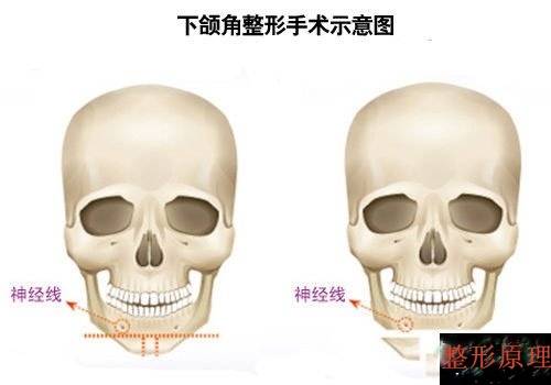 瘦脸针打一次能够达到瘦脸效果吗,瘦脸必看哪些人群不适合瘦脸针