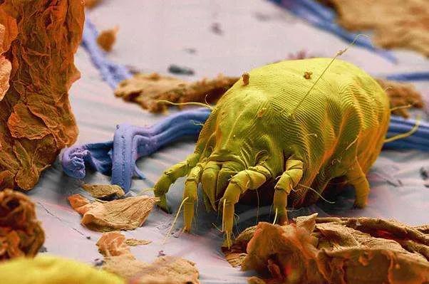 湿疹会引起流鼻涕吗,小孩流鼻涕嘴角湿疹