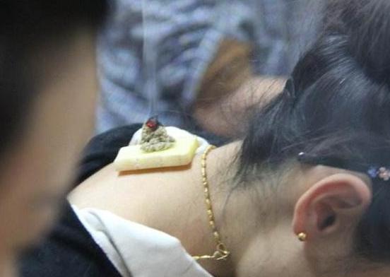 艾灸百会穴出现头晕是怎么回事,闻了艾灸味头晕恶心是怎么回事