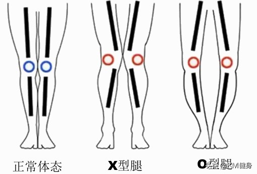 扁平足深蹲脚外侧发力,改善扁平足o型腿的训练方法