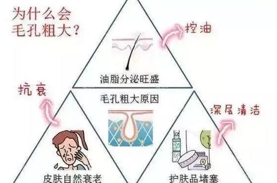 毛孔粗大原因及如何改善,毛孔粗大爱出油是什么原因