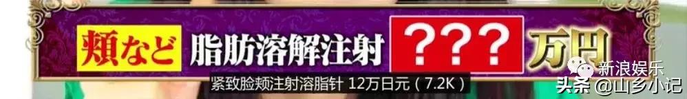 明明是整容脸现在却成了颜值巅峰,明明是整容脸却没被吐槽过