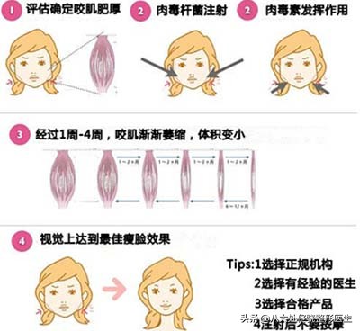 瘦脸针瘦腿针瘦肩针该怎么选,瘦肩针跟瘦脸针是不是一样的